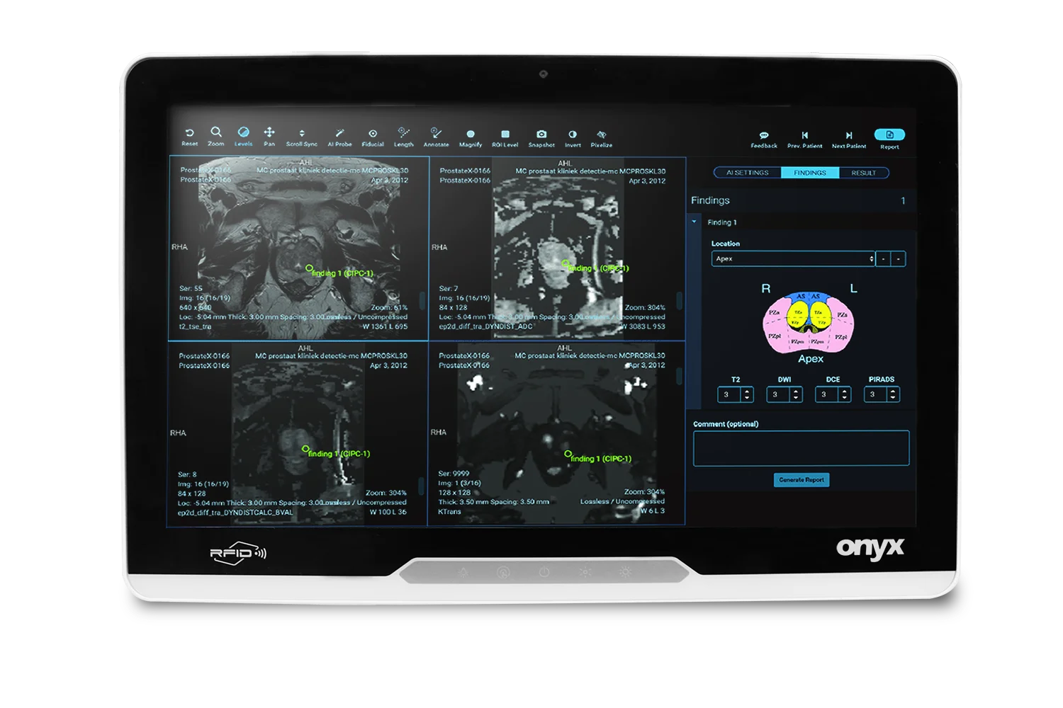 Onyx MATE2-2215