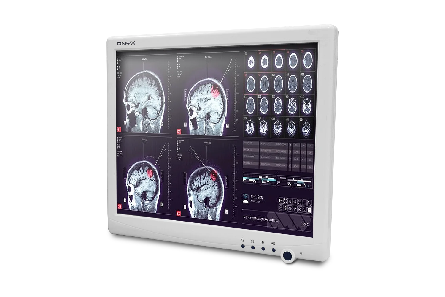 Onyx SMA-1733