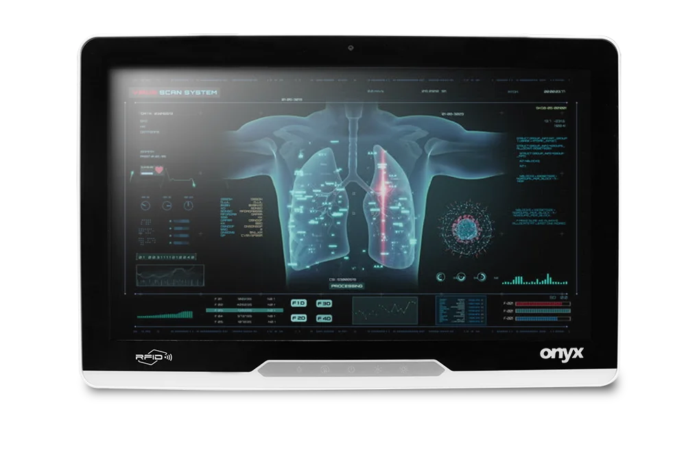 Onyx MATE2-2412