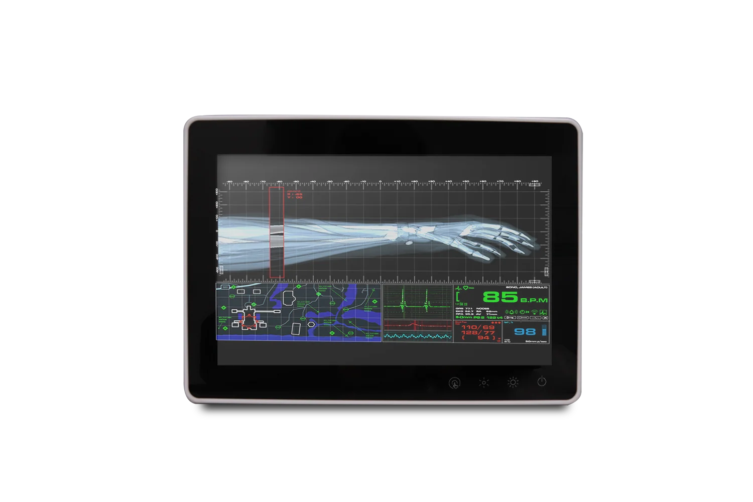 Onyx SMA-1033