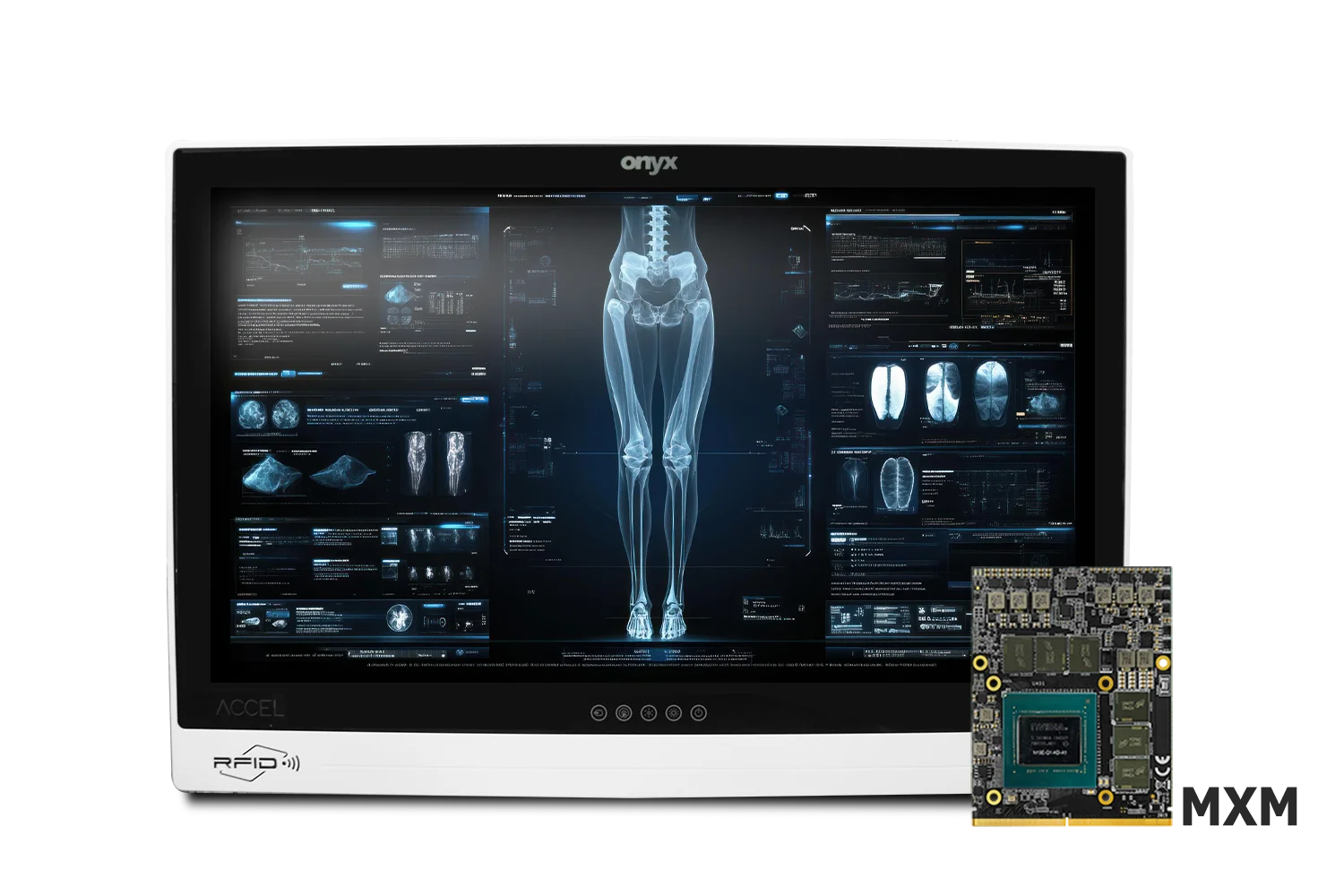 Onyx ACCEL-A2720